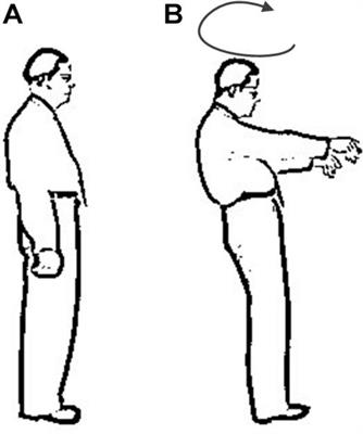 Clinical Recognition of Sensory Ataxia and Cerebellar Ataxia